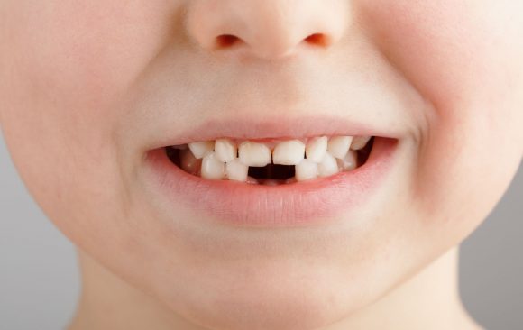 La prima visita dal dentista: i consigli per il bambino